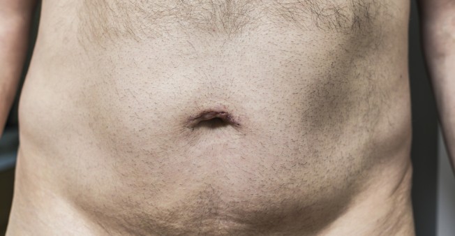 Why You Shouldn't Shave Your Pubic Hair