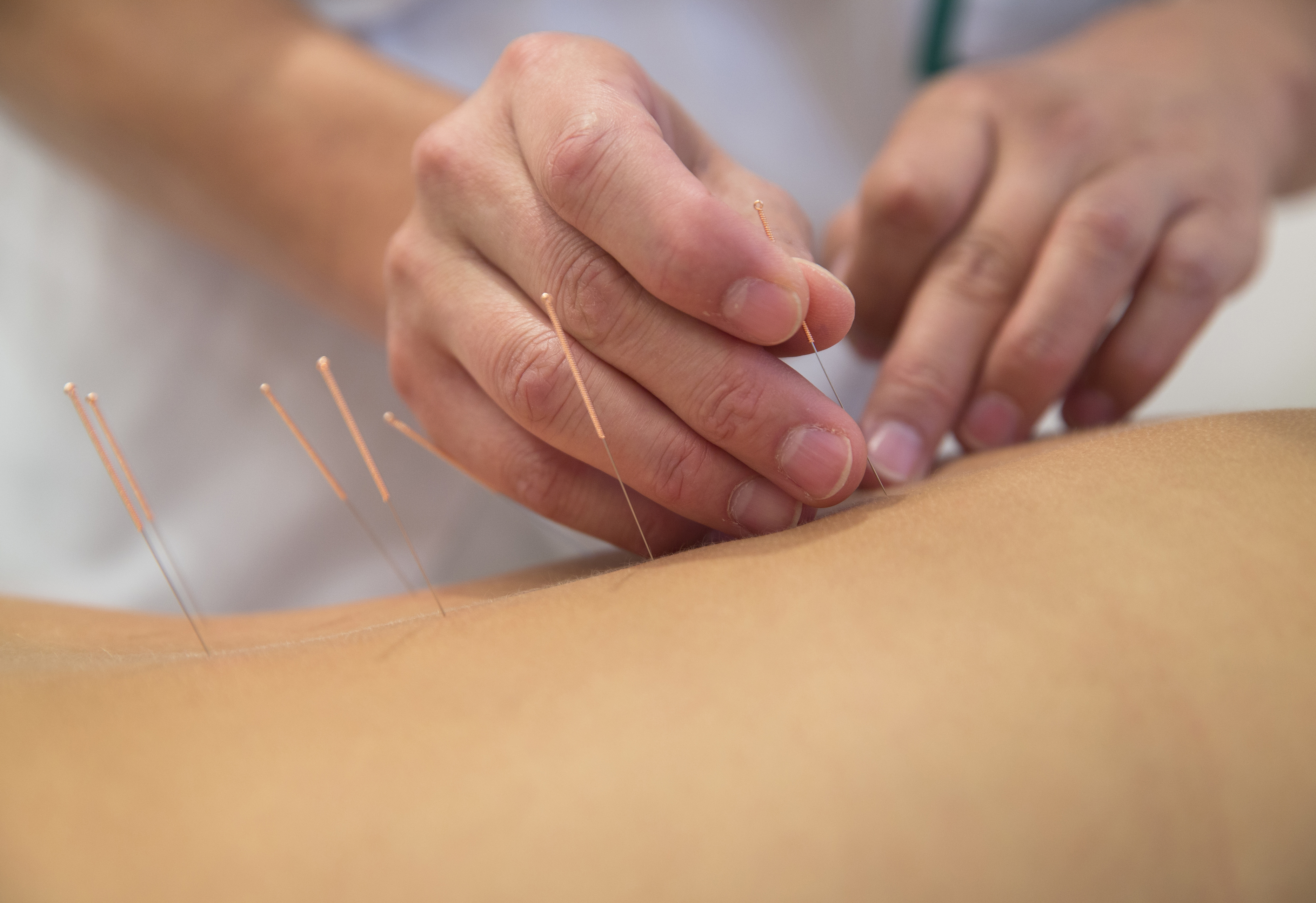Acupuncture The Science Behind It - 